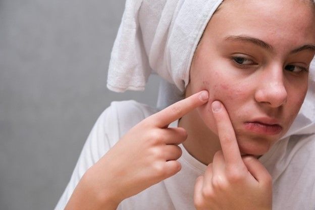  teenage girl squeezing face acne  in front of a mirror - Maintaining Acne Free Skin