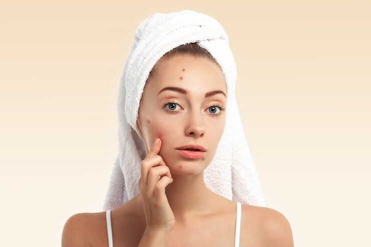 Photo by Freepik - Korean skincare for acne - woman with white towel on head 