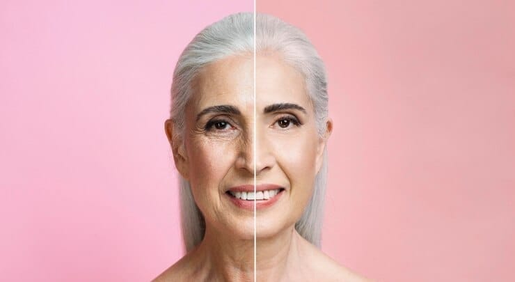 before and after older woman on pink background