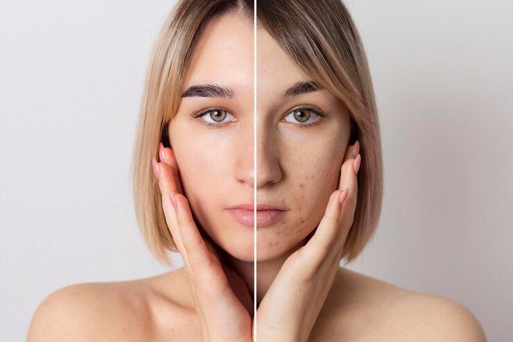 girl with hands on face on neutral background