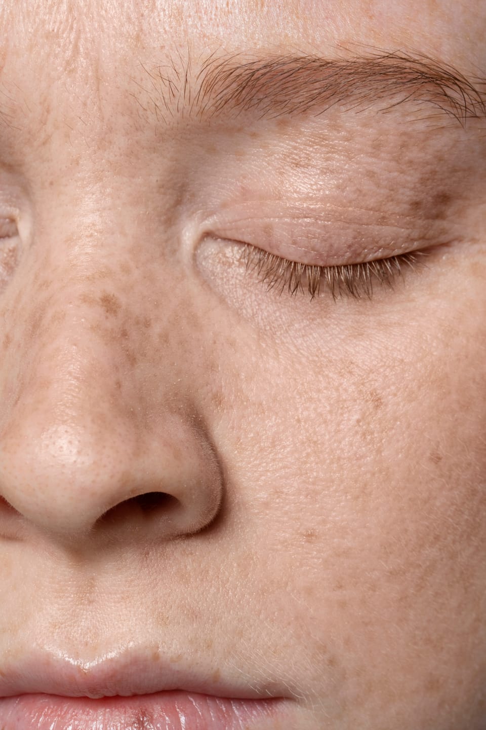 close-up image of a person showing enlarged pores -  Pore Minimizers